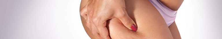 cellulite ménopause